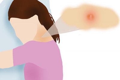 ����ʧ��֢����ҽԺ