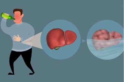 ����ʧ��֢����ҽԺ